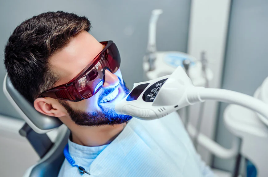 laser-teeth-whitening