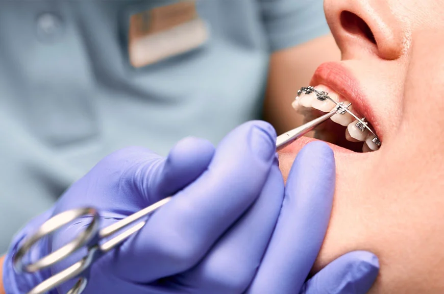 orthodontics